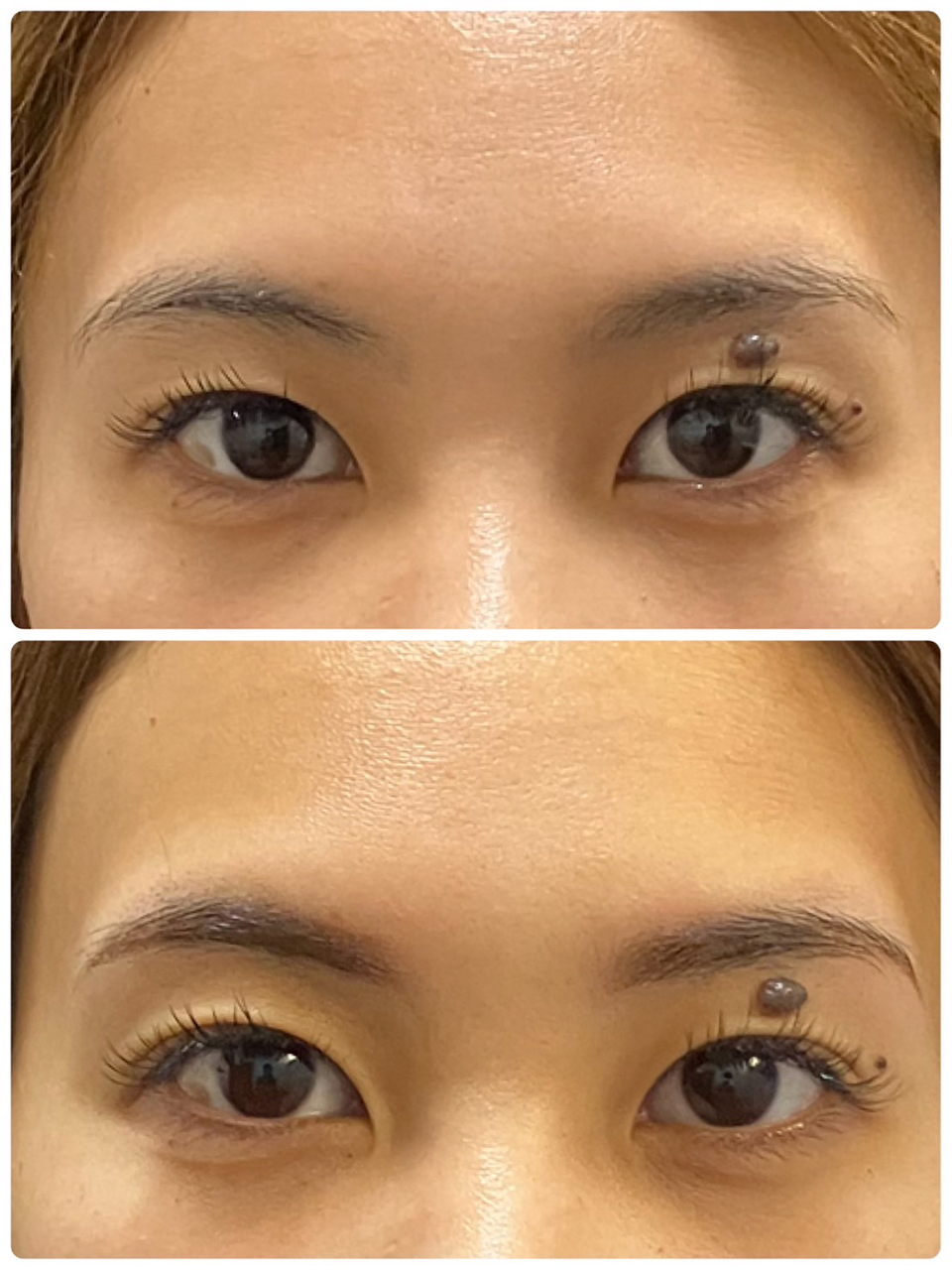 アンフェイドメイク（眉毛タトゥー）