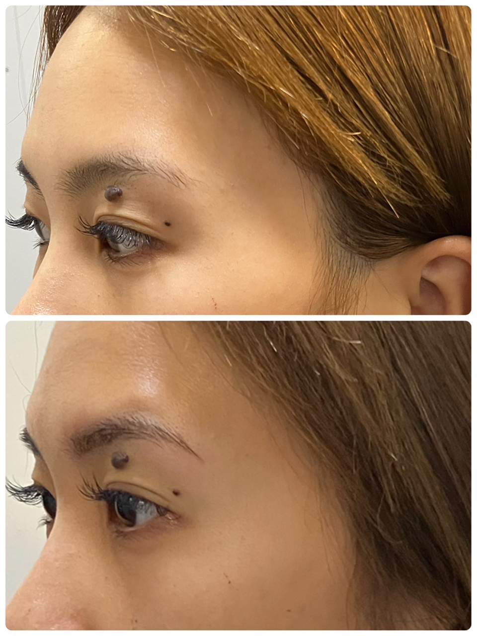 アンフェイドメイク（眉毛タトゥー）