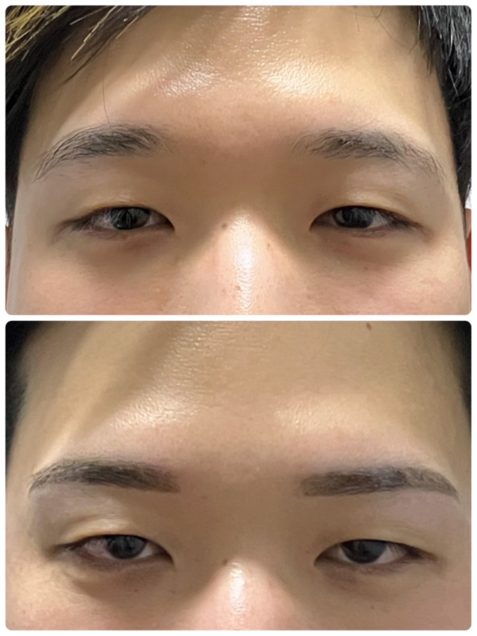 アンフェイドメイク（眉毛タトゥー）