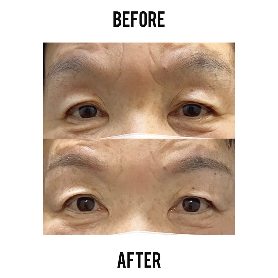 アンフェイドメイク（眉毛タトゥー）